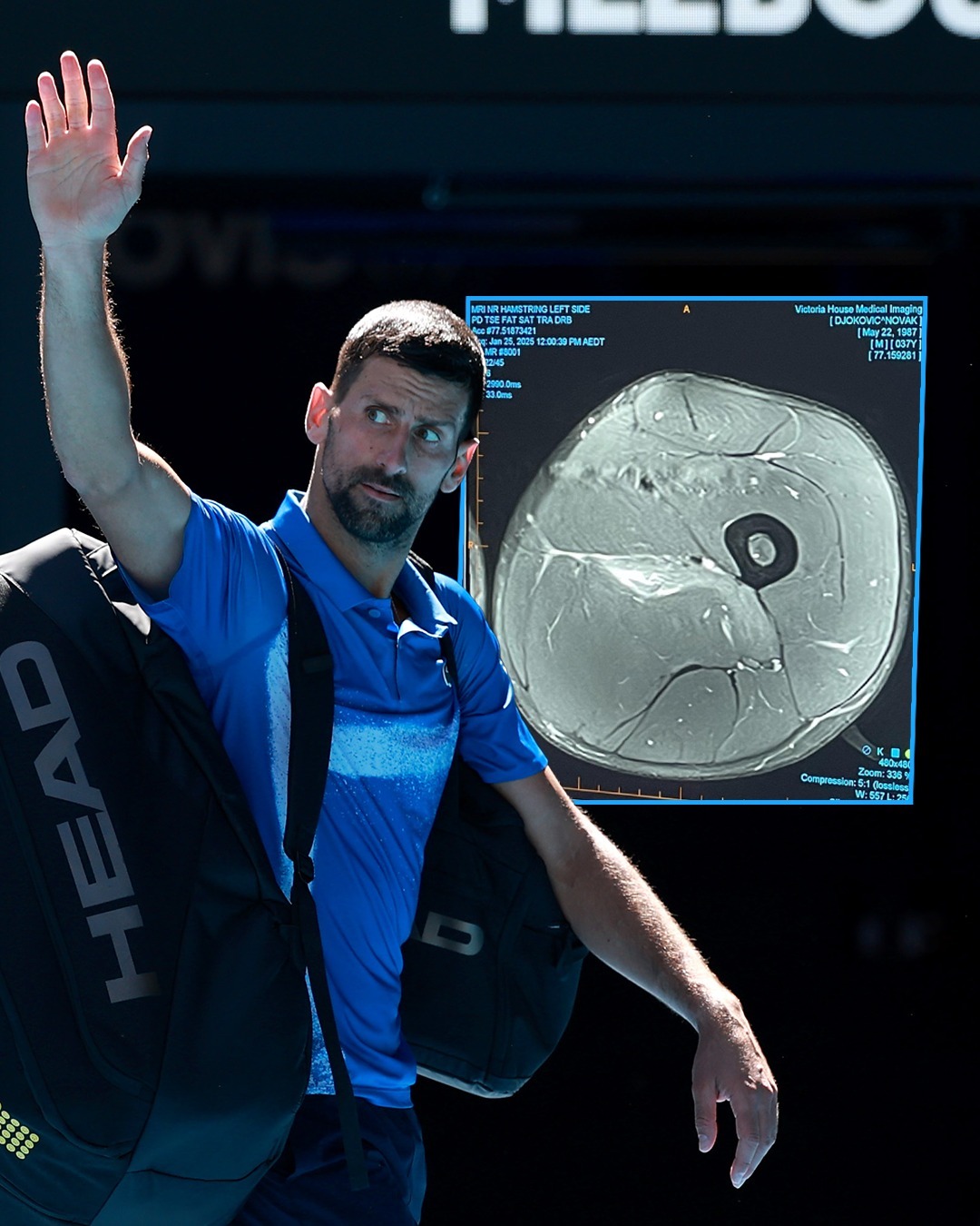 日本网球队碾压法国网球队，德约科维奇高光表现的简单介绍